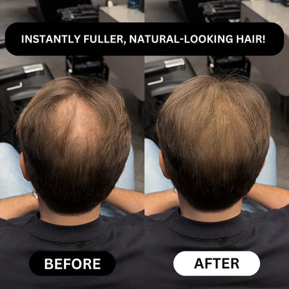 Dexaro™ - Hair Density Powder